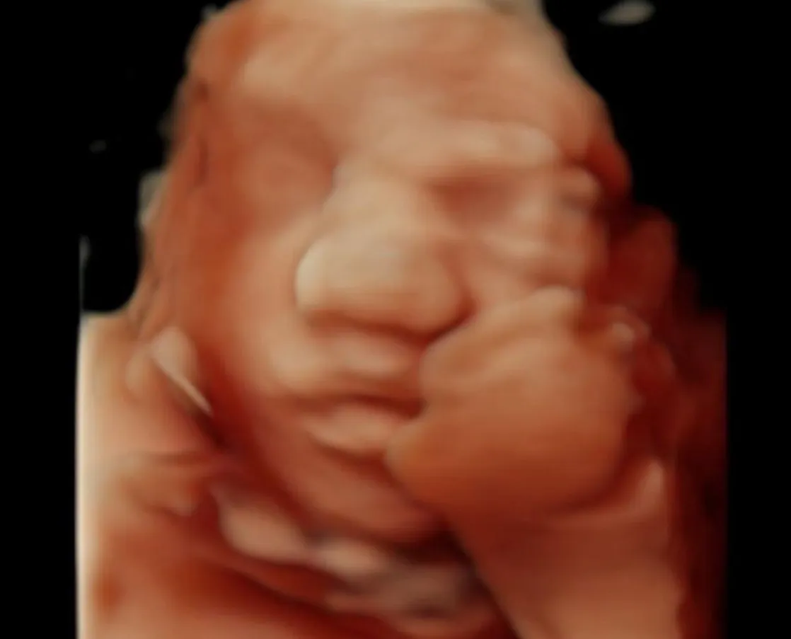 ultrassom 3d (2)