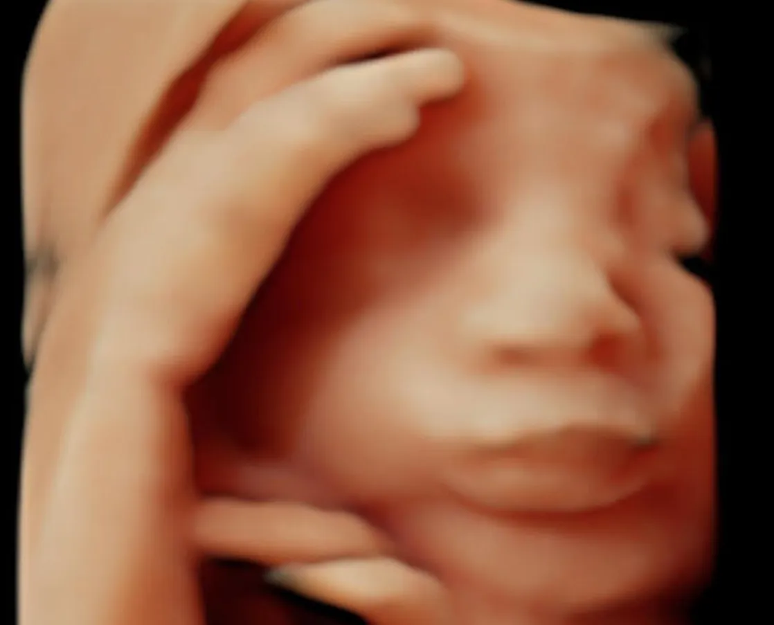 ultrassom 3d (4)